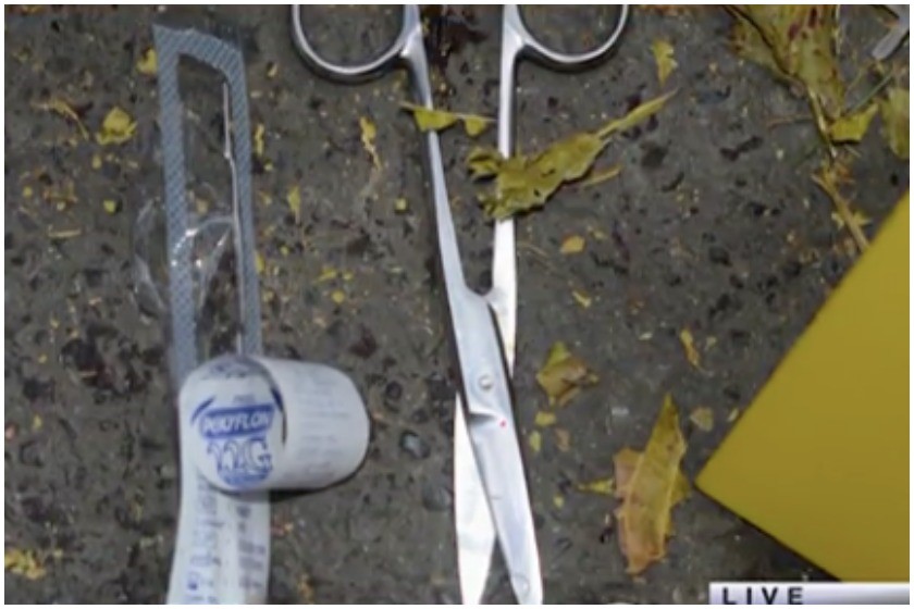 შემთხვევის ადგილიდან ამოღებული
სამედიცინო მაკრატელი