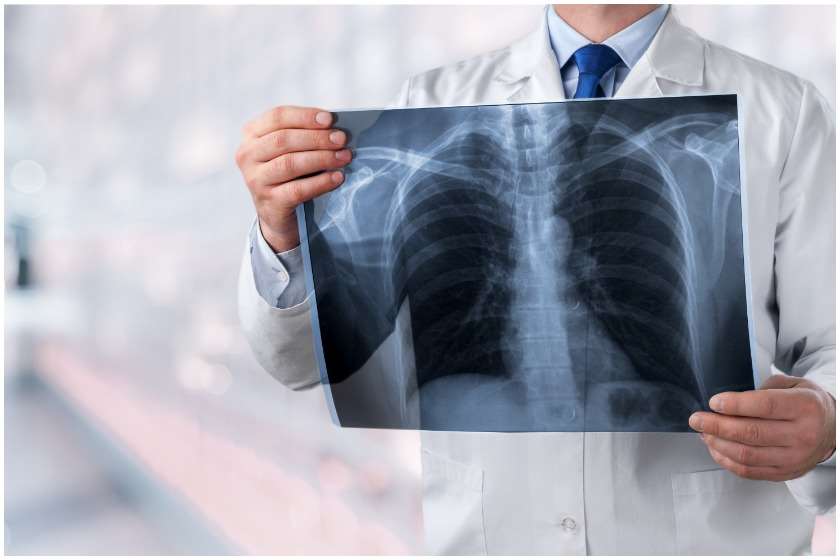 საქსტატი