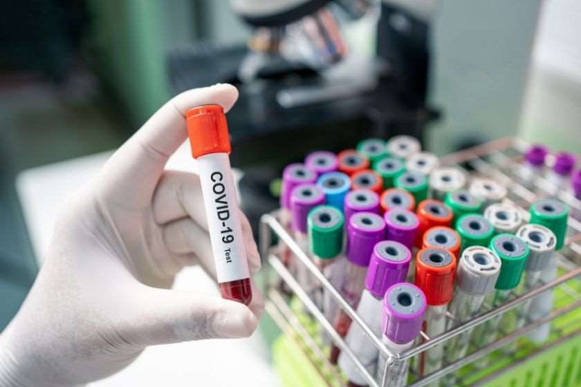 კორონავირუსი