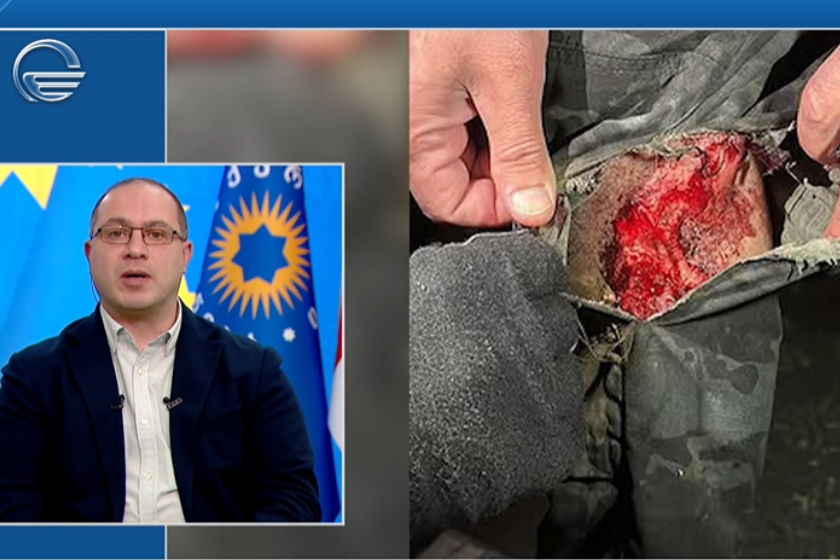 გივი მიქანაძე